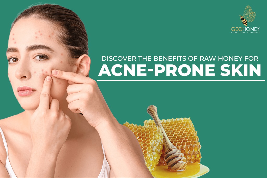 A jar of raw honey with a honey dipper, Raw honey is a natural remedy exploring the benefits of raw honey for acne-prone skin.